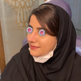 عکس دماغ عملی طبیعی
