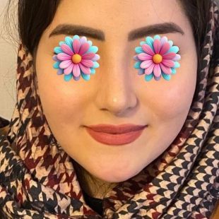 عکس بینی طبیعی زیبا